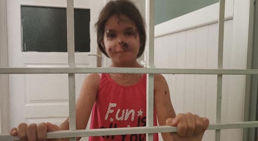 Küçük Cemile 6 yıldır karanlık odada yaşıyor! Kabusu iki yaşında başladı