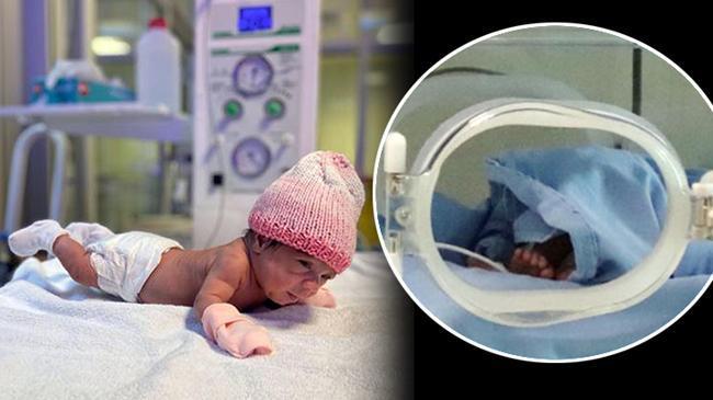 515 gramlık Elif bebek mucizesi!