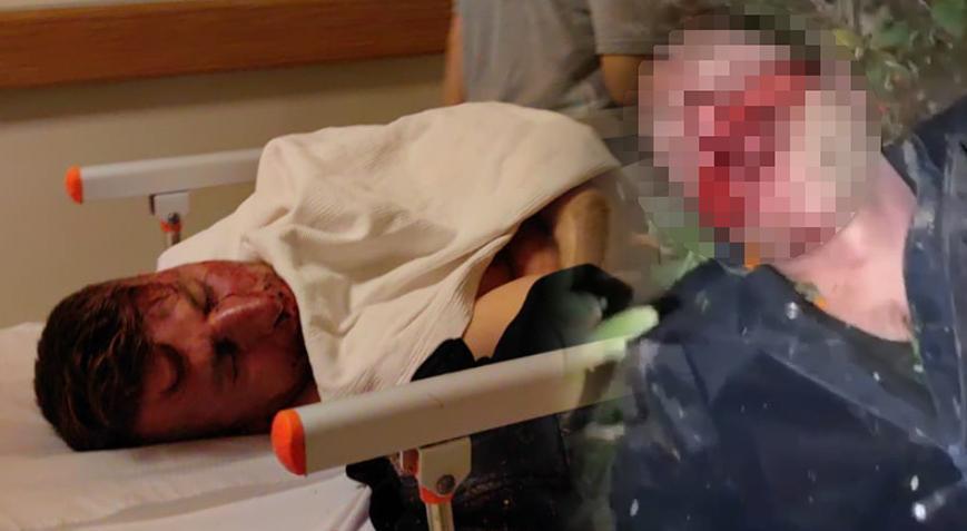 Kaldırım taşı ile darbedildi! Şok gerçek ortaya çıkınca tutuklandı