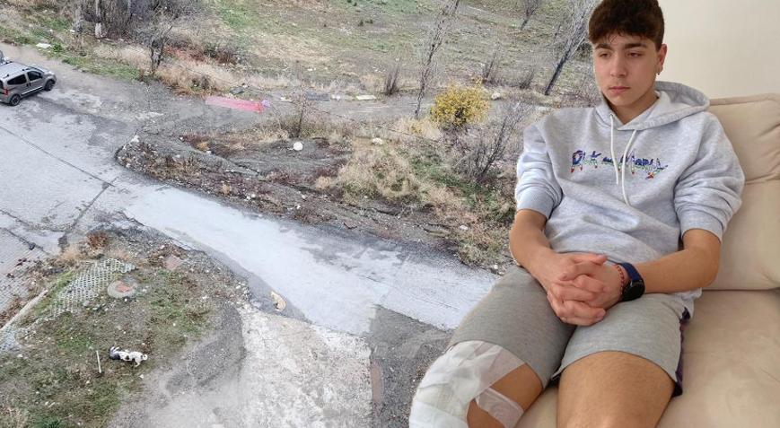 Başıboş köpekler okula giden çocuğa saldırmıştı! Ailesi harekete geçti