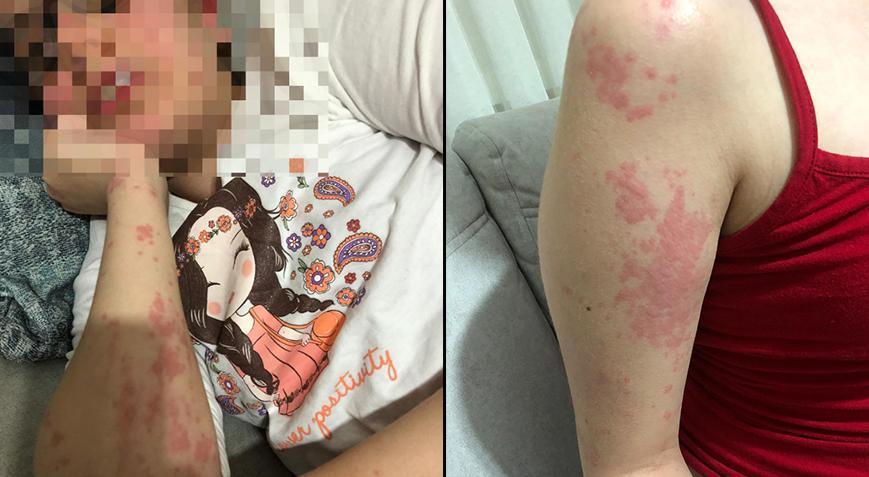 Eczacının verdiği ilaç otizmli Zeynep’in kabusu oldu!