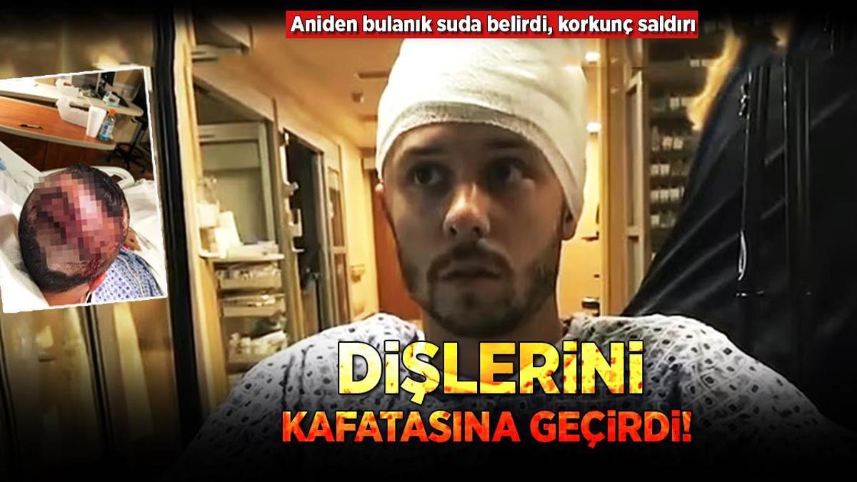 Aniden bulanık suda belirdi, dişlerini kafatasına geçirdi!