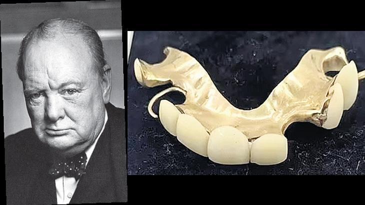 Takma dişleri müzayedede!