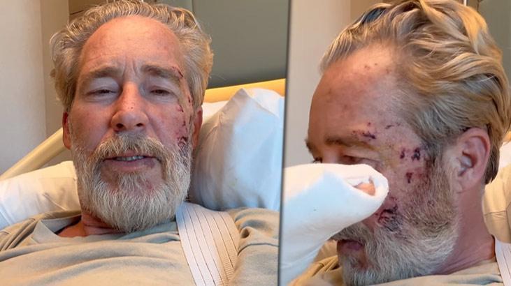 Sinan Albayrak sette kaza geçirdi! Bir süre şuurunu kaybetti