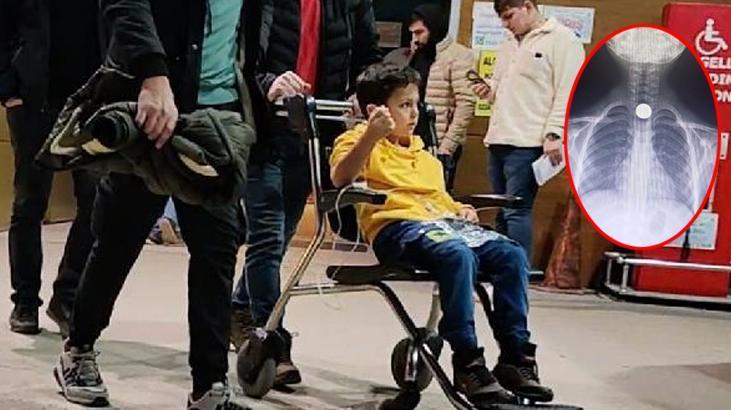 Minik Ahmet bozuk para yuttu yemek borusuna takıldı