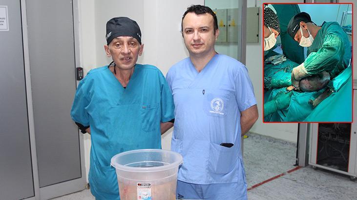 10 kiloluk kitle karnından çıktı