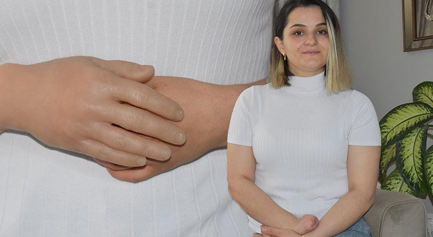 Elini kıyma makinesine kaptıran 3 çocuk annesi protez eline kavuştu