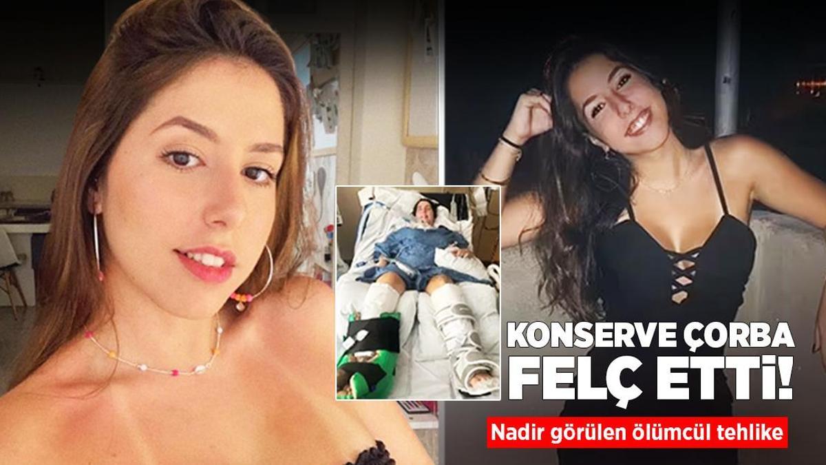 Konserve çorba içti, felç oldu! Nadir görülen ölümcül tehlike