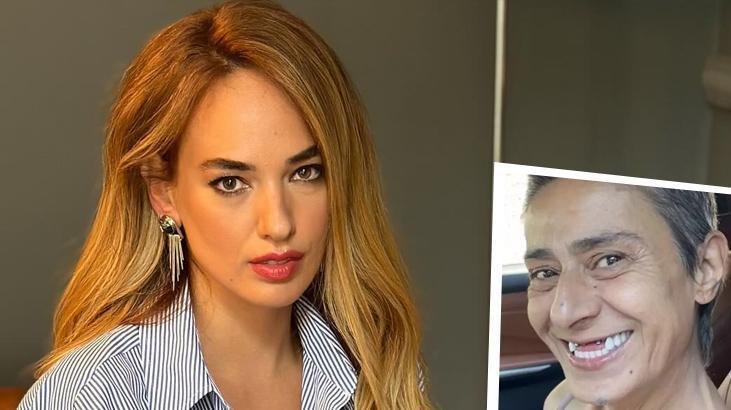 Seda Bakan’dan Yıldız Tilbe’ye destek! Dişsiz halini paylaştı