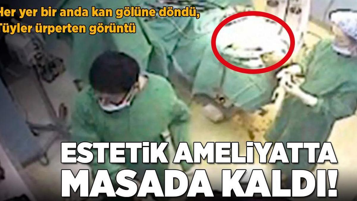 Estetik ameliyatta masada kaldı! Her yer bir anda kan gölüne döndü, tüyler ürperten görüntü
