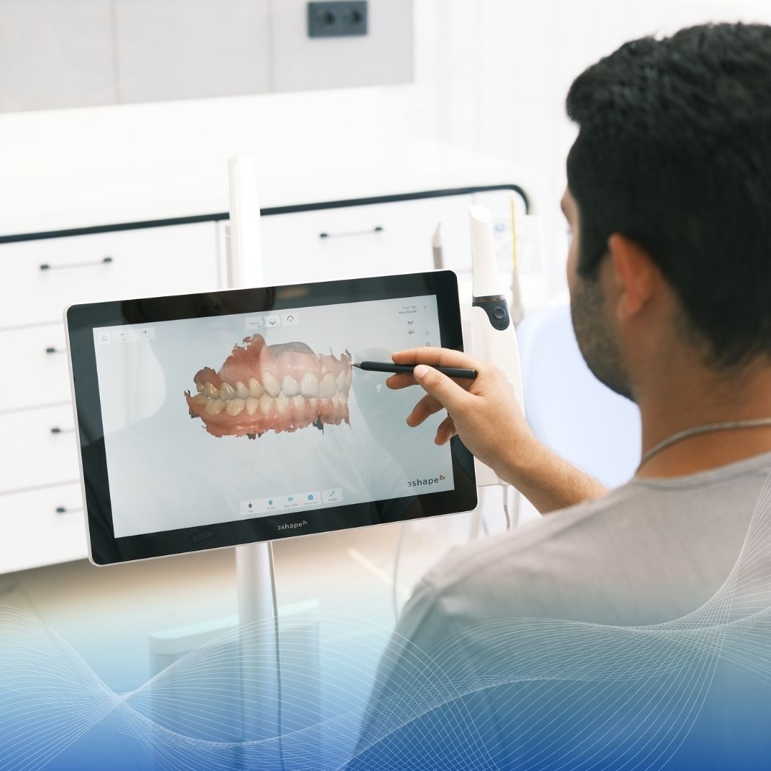 Marmaris’te Son Teknoloji Diş Hekimliği: Intraoral Tarayıcılar ve Dijital Cad/Cam Sistemleri