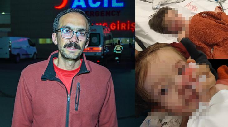 Ankara’da Pitbull Dehşeti: Aynı Aileden 1,5 ve 5 Yaşındaki İki Çocuk Yaralandı