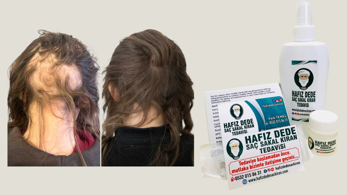 Hafız Dede Saç Kıran Tedavisi: Sınır Tanımayan Doğal Güç