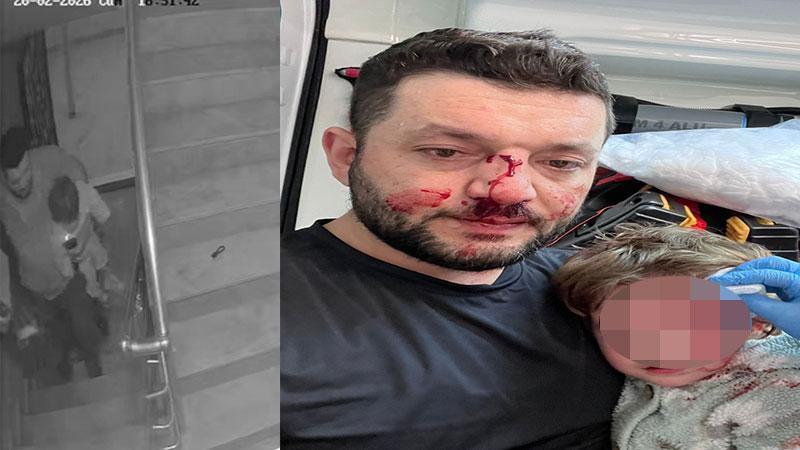 İkra Bebeğin Adalet Çığlığı! 14 Aylık Bebeği Yaralayan Sanığa Tahliye Kararı