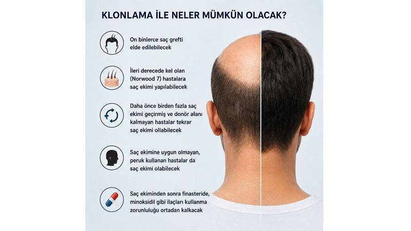 Saç klonlamasında umut veren gelişme! ‘Donör yetersizliği tarihe karışabilir’