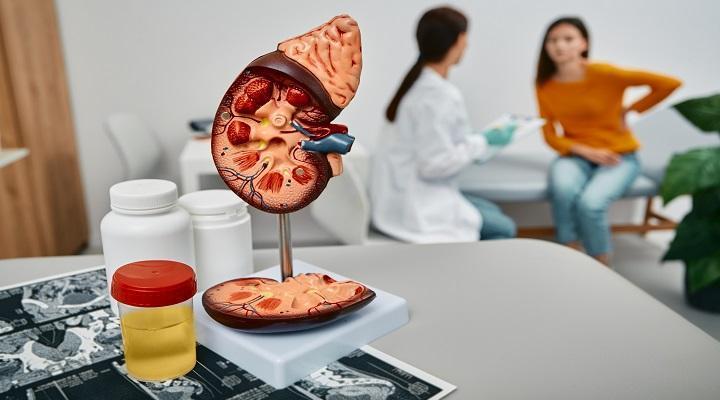 Böbrek kanseri çoğu zaman belirti vermeden ilerliyor