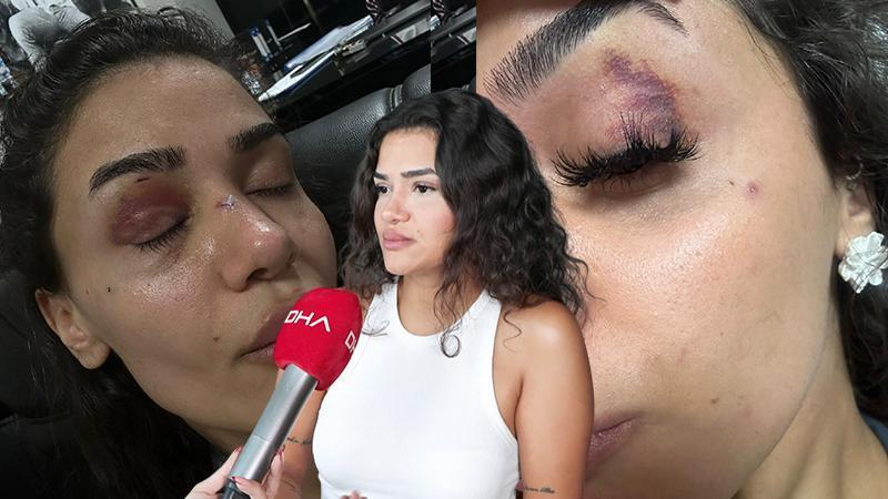 Uzaklaştırma kararına rağmen eski sevgilisinin saldırısına uğradığını öne sürdü: “Lütfen beni koruyun”